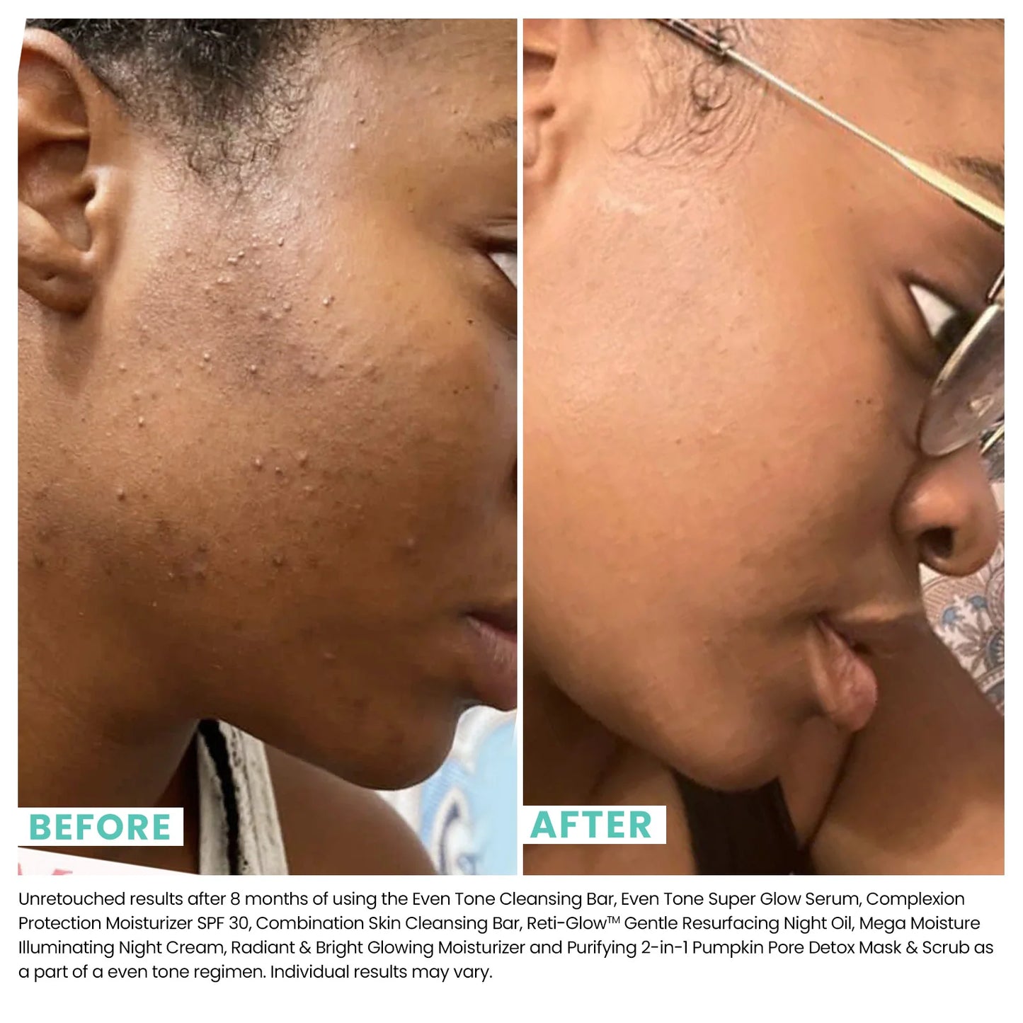 UrbanSkinRX Dark Spot 8% AHA Polish